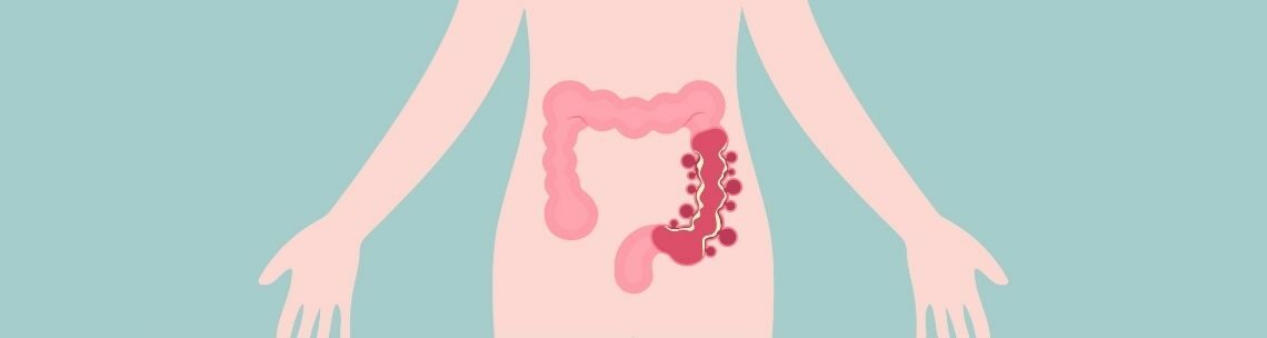 Image of IBS-D